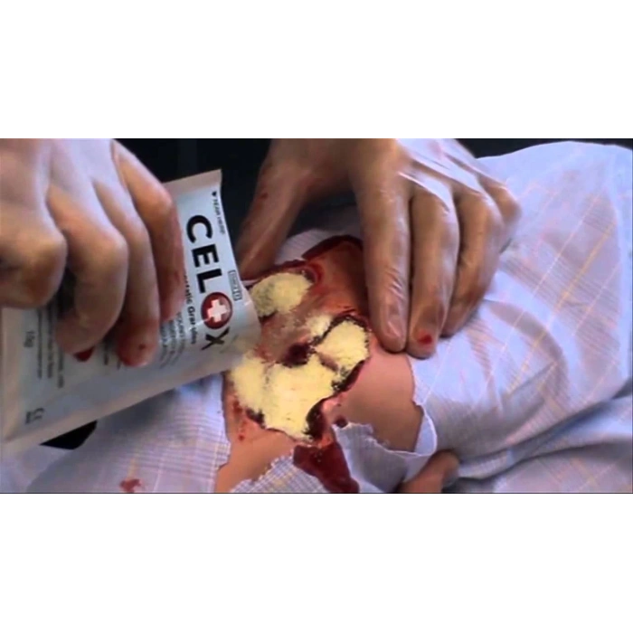 Celox hemostatic granules Kan Durdurucu