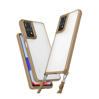 Mey İthalat®   Redmi Note 11 Pro Kılıf Penta Silikon Kılıf - Çöl Titanyum