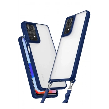 Mey İthalat®   Redmi Note 11 Pro Kılıf Penta Silikon Kılıf - Lacivert