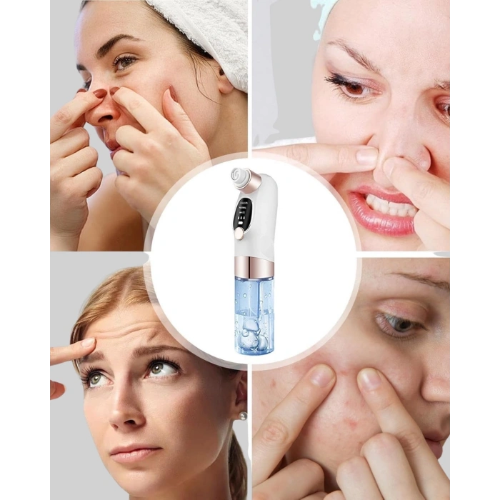 BFS Elektrikli Siyah Nokta Cihazı