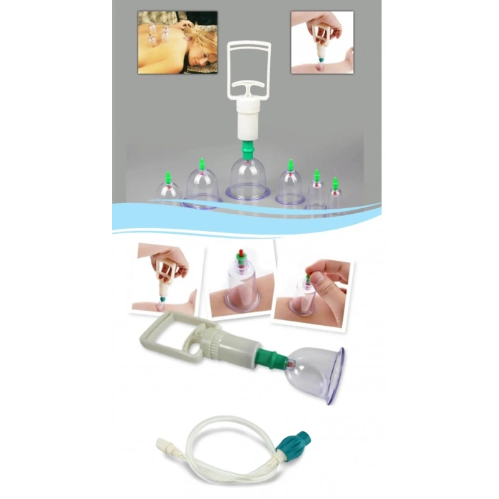 Hacamat Seti Hortumlu - Vakumlu Hortumlu Kupa Çekme Seti (model 1)