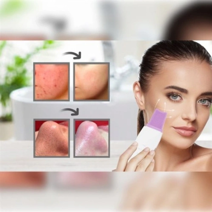 Mey İthalat® ULTRASONIC SİYAH NOKTA  AKNE SPATULA ŞARJLI CİLT TEMİZLEYİCİ