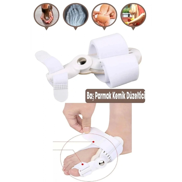 2 Adet Ayak Baş Parmak Kemik Düzeltici Ayak Bakımı Özel Tasarım Halluks Valgus Bunyon Ateli