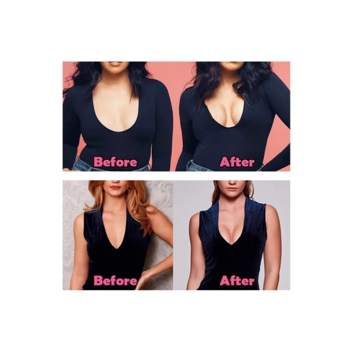 Göğüs Dikleştirici Ve Şekillendirici Bant (breast Lift And Shaper Tape)