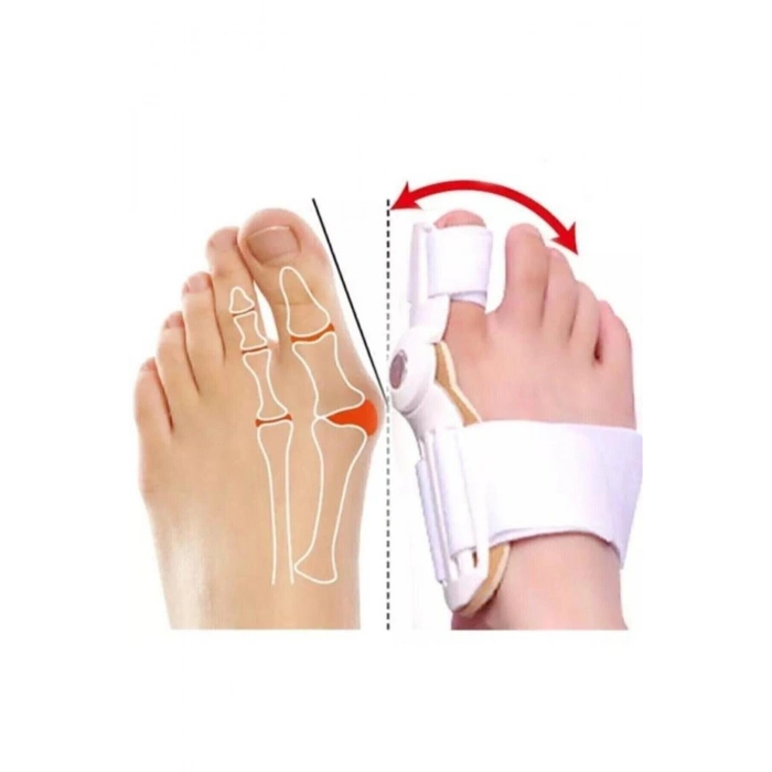 Başparmak Kemik Düzeltici 180° Esnek Ayarlanabilir Halluks Valgus Aparatı