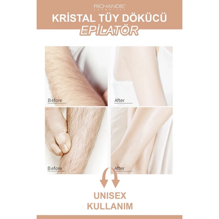 Crystal Eraser Epilasyon Aleti Tüy Silgisi Tüy Alıcı Fiziksel Kristal Tüy Dökücü Epilatör Gold Krom
