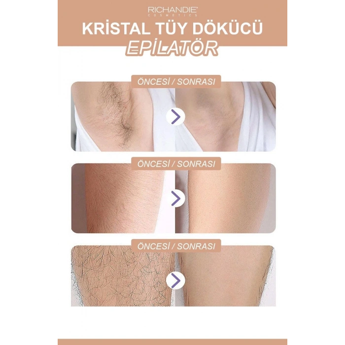 Crystal Eraser Epilasyon Aleti Tüy Silgisi Tüy Alıcı Fiziksel Kristal Tüy Dökücü Epilatör Gold Krom