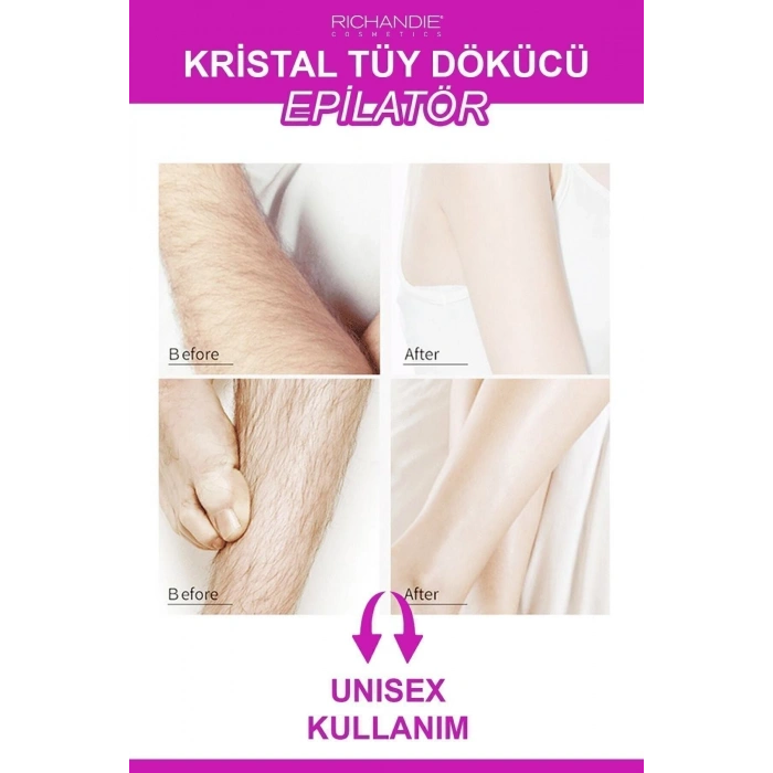 Kristal Tüy Dökücü Ağda Epilatör Crystal Eraser Epilasyon Aleti Tüy Silgisi Tüy Alıcı Fiziksel Pembe