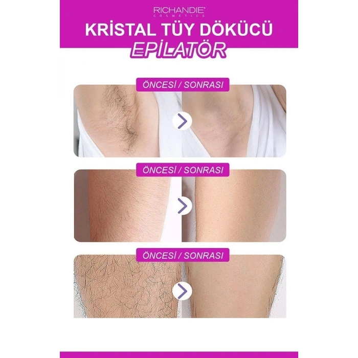 Kristal Tüy Dökücü Ağda Epilatör Crystal Eraser Epilasyon Aleti Tüy Silgisi Tüy Alıcı Fiziksel Pembe