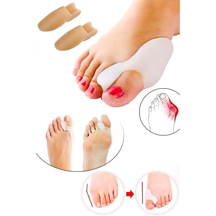 Ayak Başparmak Kemik Koruyucu Halluks Valgus Parmak Koruyucu Kemik Çıkıntısı Önleyici