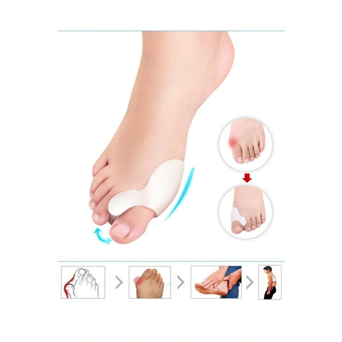 Ayak Başparmak Kemik Koruyucu Halluks Valgus Parmak Koruyucu Kemik Çıkıntısı Önleyici