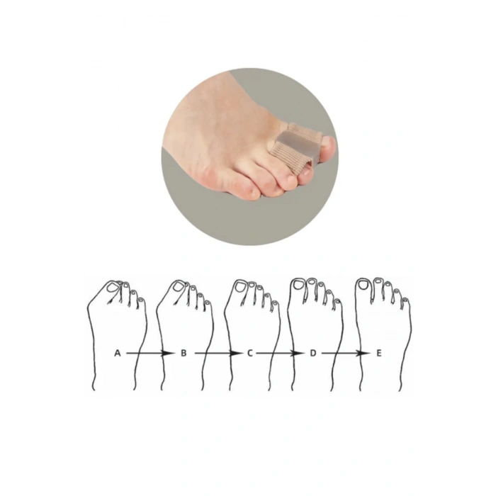 Ayak Baş Parmak Kemik Eğriliği Düzeltici Halluks Valgus Parmak Koruyucu Silikon Gece Gündüz Aparat L