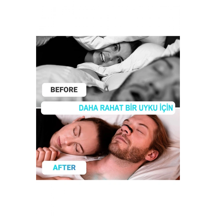 Horlama Önlemeye Yardımcı Mıknatıslı Burun Dilatörü 4lü Set - Siyah-15 Li