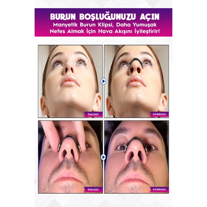 Horlama Önleyici Mıknatıslı Burun Bandı 30lu Set, Premium Horlama Azaltıcı Estetik Siyah Dilatör