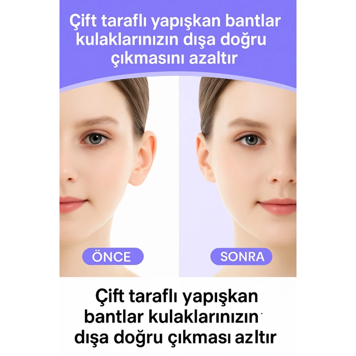 Görünmez Kepçe Kulak Kapatıcı Bant – 6’lı Kepçe Kulak Düzeltme Bandı