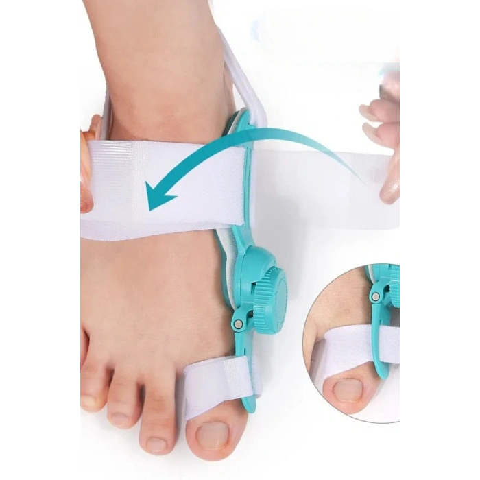 Halluks Valgus Gece Ateli Ayarlı Ayak Baş Parmak Kemik Düzeltici Başparmak Eğriliği Düzeltme