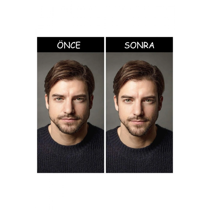 Jawline Çene Topu Çene Kası Güçlendirici Top Orta Seviye Fitnes Çene Çizgisi Çıkarıcı Top