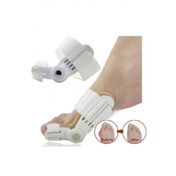 Başparmak Kemik Düzeltici 180° Esnek Ayarlanabilir Halluks Valgus Aparatı
