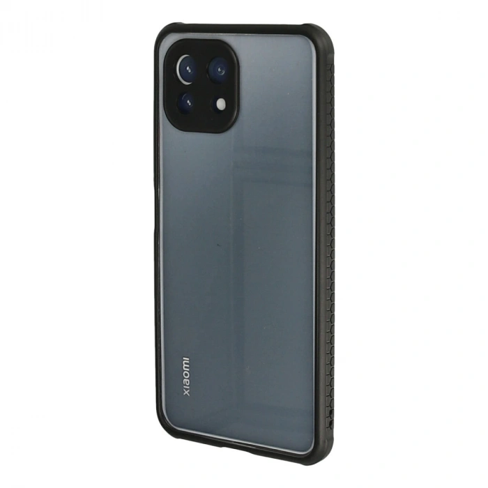 Xiaomi Mi 11 Lite Kılıf Miami Şeffaf Silikon - Siyah