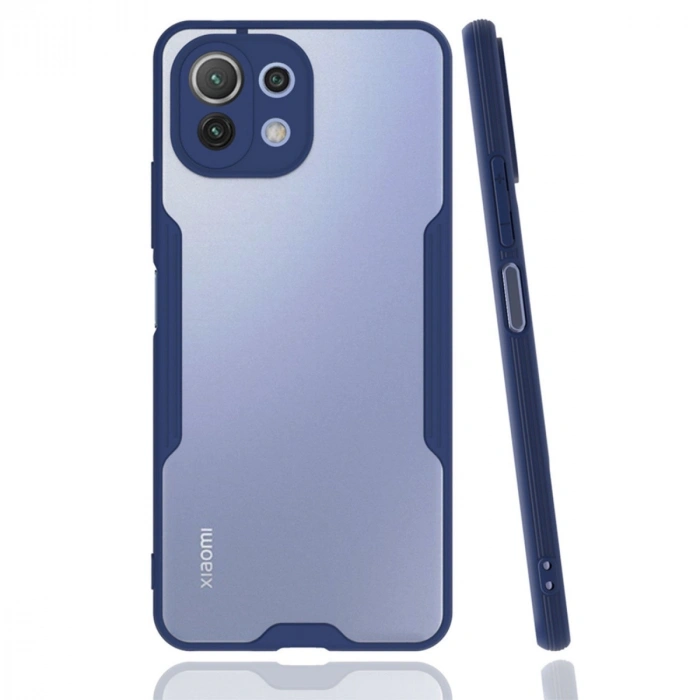 Xiaomi Mi 11 Lite Kılıf Platin Silikon - Lacivert