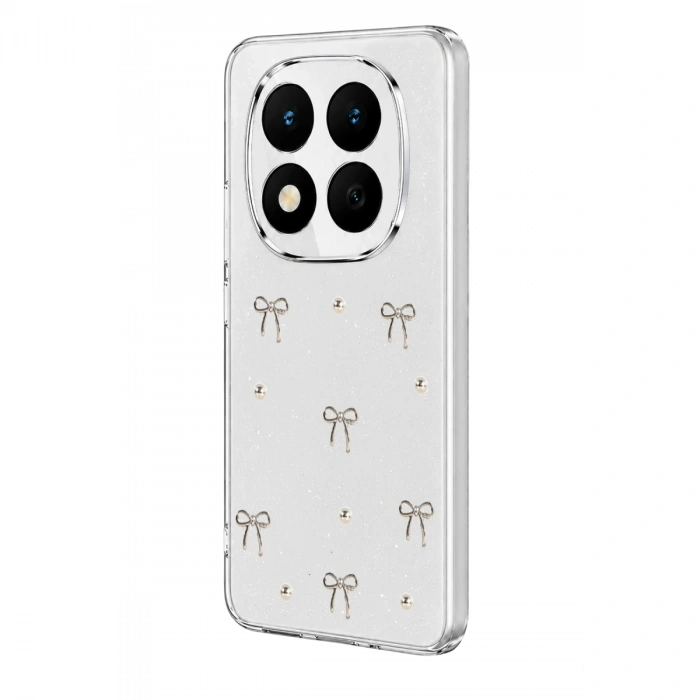 Xiaomi Redmi Note 15 Pro 4g Fiyonk Desenli Kapak - Desen 5