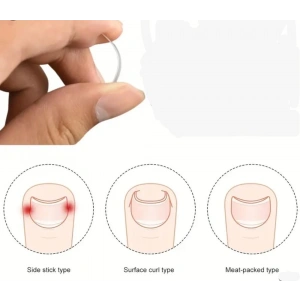 Baş Parmak Tırnak Batmasını Engelleyen Metal Aparat Nrd 603 *