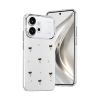Huawei Honor 600 Fiyonk Desenli Kapak - Desen 1