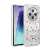 Onegif Xiaomi Redmi 14c Misk Simli Magsafe Kapak - Desen 5