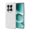 Xiaomi Redmi Note 15 Pro 4g Fiyonk Desenli Kapak - Desen 4