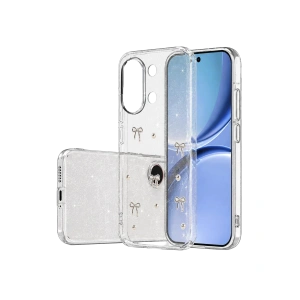 Newface Xiaomi Poco X8 Pro Max Fiyonk Desenli Kapak - Desen 5