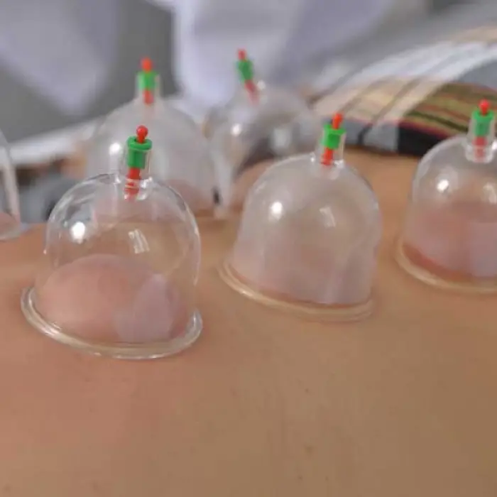6 Adet Kupa Çekme Hacamat Seti