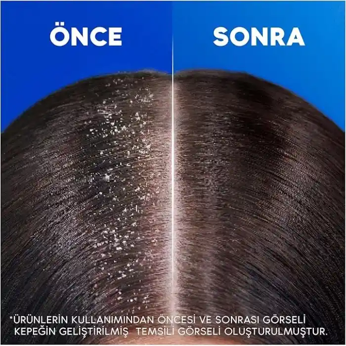 Head & Shoulders Klasik Bakım Kepeğe Karşı Etkili Şampuan 800ml