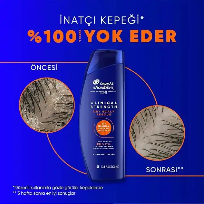 Head & Shoulders Clinical Strength Dry Scalp Rescue Kuru Saç Derisine Özel Şampuan 400 ml