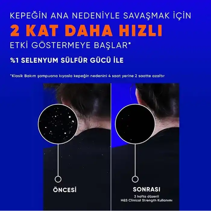Head & Shoulders Clinical Strength Dry Scalp Rescue Kuru Saç Derisine Özel Şampuan 400 ml