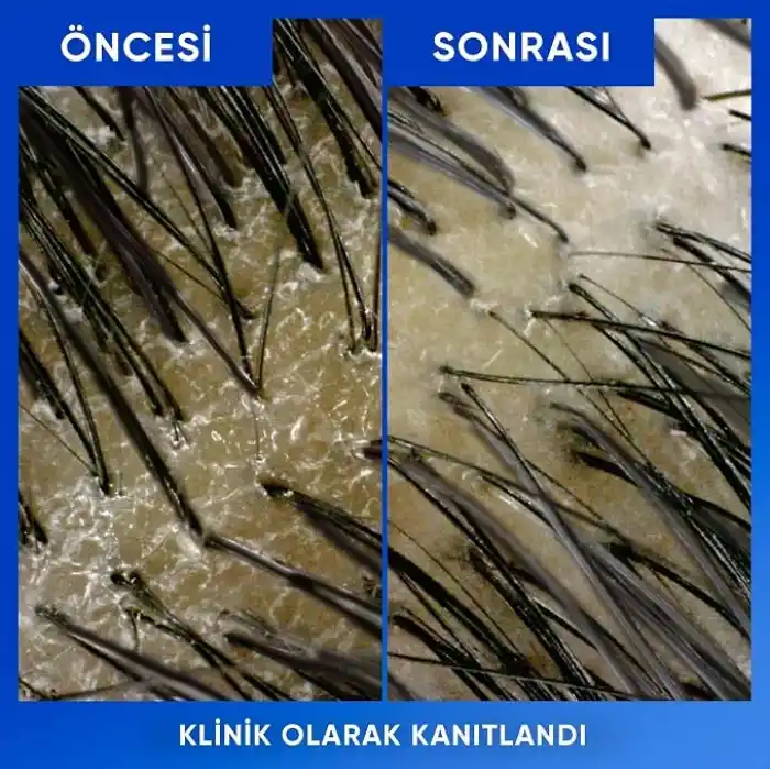 Head & Shoulders Arındırma ve Parlaklık Kepeğe Karşı Etkili Şampuan 800ml