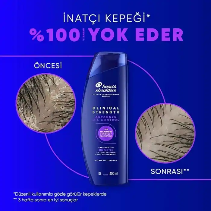 Head & Shoulders Clinical Strength Advanced Oil Control Yağ Dengeleyici Şampuan 400 ml
