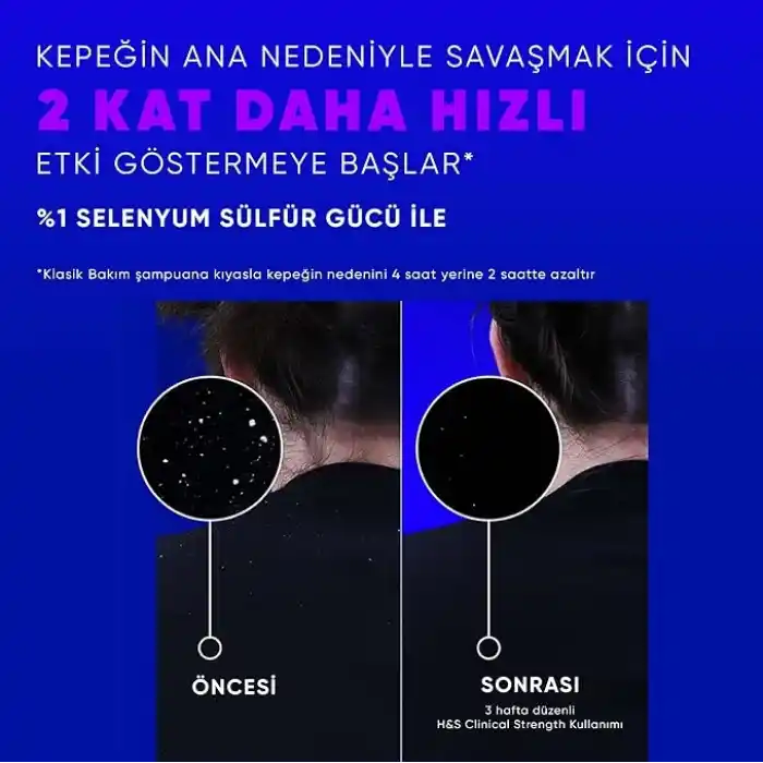Head & Shoulders Clinical Strength Advanced Oil Control Yağ Dengeleyici Şampuan 400 ml
