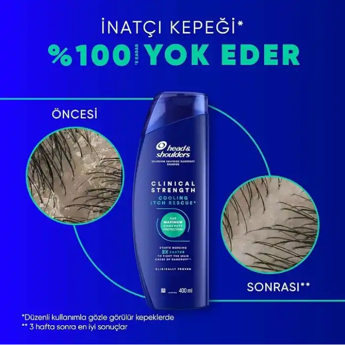 Head&Shoulders Clinical Strength Cooling Itch Rescue Kaşıntı Karşıtı Şampuan 400 ml