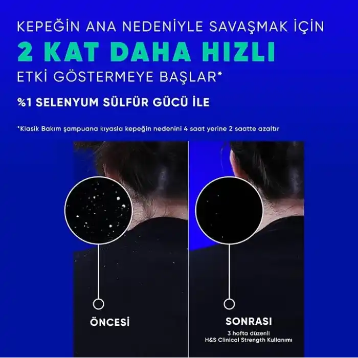 Head&Shoulders Clinical Strength Cooling Itch Rescue Kaşıntı Karşıtı Şampuan 400 ml