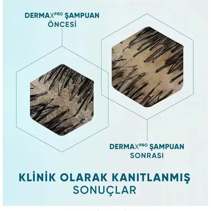 Head & Shoulders DermaXPro Yatıştırıcı Kepek Karşıtı Şampuan Kuru ve Kaşıntılı Saç Derisi için 300 ML