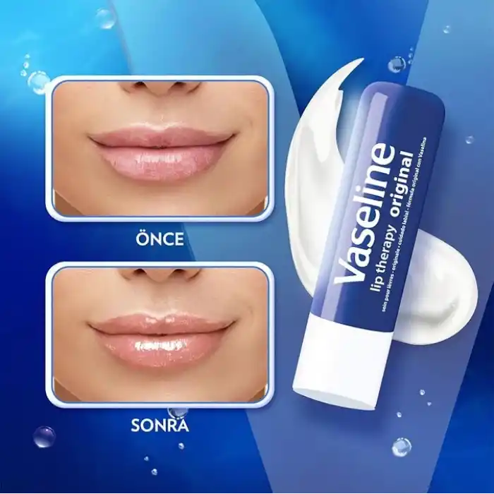Vaseline Lip Therapy Dudak Bakım Kremi Original 4.8 gr