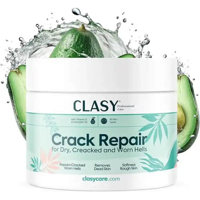 CLASYCARE Topuk Çatlağı Kremi – Kuru ve Çatlamış Topuklar için – E Vitamini ve Avokado Yağlı Topuk Kremi – Nasır, Sert ve Ölü Deriler için Nemlendirici Ayak Bakım Kremi – 100 ml