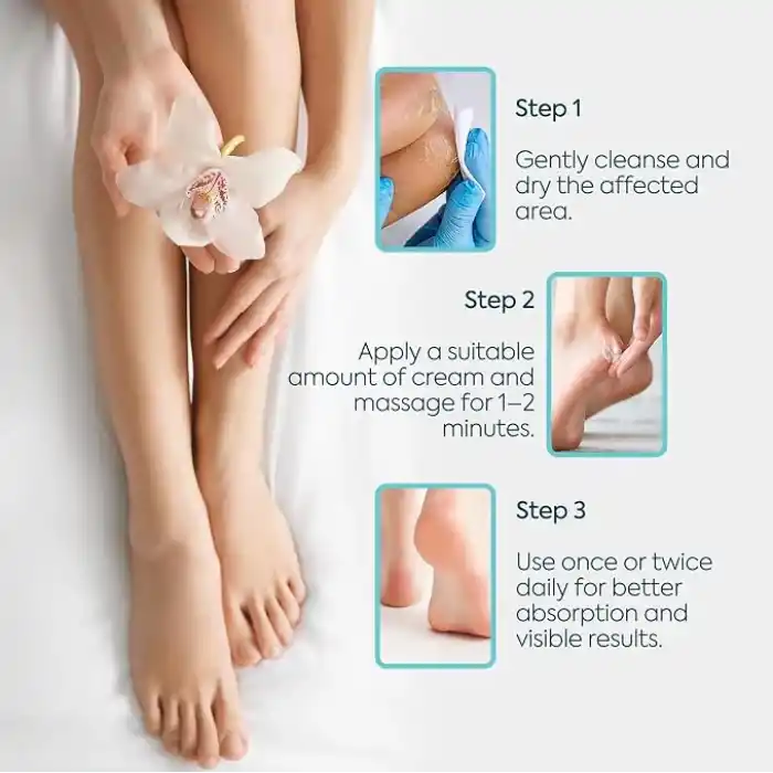 CLASYCARE Topuk Çatlağı Kremi – Kuru ve Çatlamış Topuklar için – E Vitamini ve Avokado Yağlı Topuk Kremi – Nasır, Sert ve Ölü Deriler için Nemlendirici Ayak Bakım Kremi – 100 ml