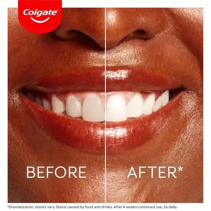 Colgate Optic White Oxygen Aktif Oksijen Teknolojisi Beyazlatıcı Diş Macunu 75 ml