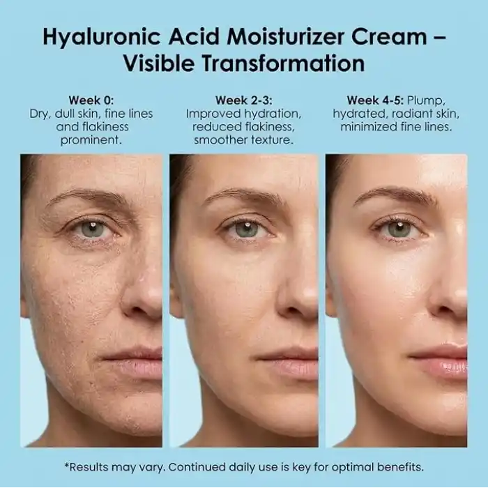 Maruderm Hyalüronik Asit Nemlendirici Yüz Bakım Kremi – Hyalüronik Asit ile Yoğun Nem ve Aydınlatma Desteği 200 ML