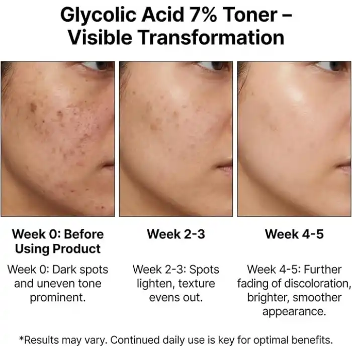 Maruderm Glikolik Asit%7 Aydınlatıcı ve Leke Görünümü Karşıtı Tonik – Meyan Kökü & Hyaluronik Asit ile Pürüzsüzleştirici Peeling Tonik, 250 ML