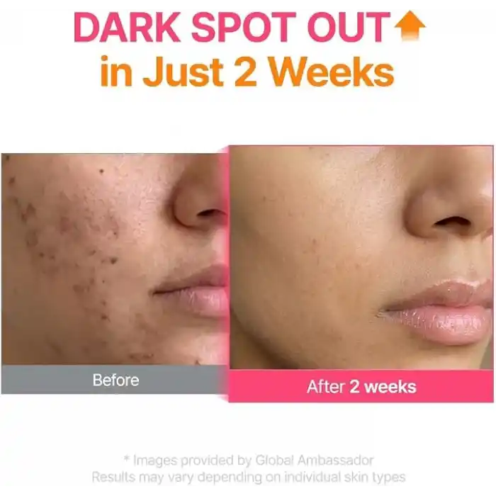 Purito TXA 6 Niacinamide 10 Retinal Serum | Leke Karşıtı Aydınlatıcı Yaşlanma Karşıtı Serum 30 ml