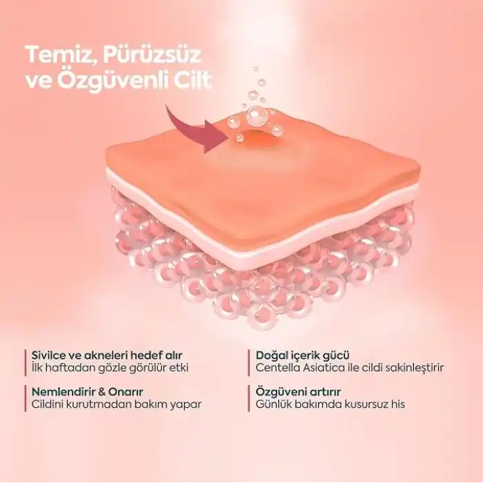 CLASYCARE Akne Kremi Yüz İçin – Sivilce ve Akne Karşıtı Leke Kremi – Salisilik Asit & Niasinamid ile Leke Giderici – Genç ve Yetişkin Cilt Bakımı, 40 ml