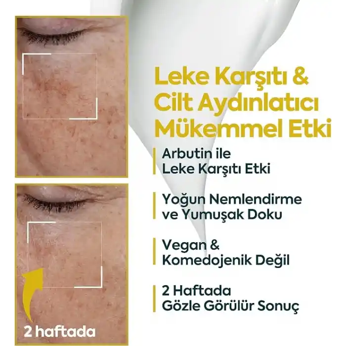 CLASYCARE Leke Karşıtı Aydınlatıcı – Yüz İçin Koyu Leke Giderici, Siyah Nokta Karşıtı Cilt Bakım Kremi, Komedojenik Olmayan Hafif Nemlendirici, 40 ml