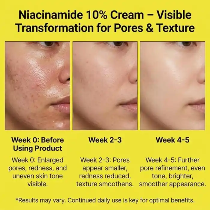 Maruderm Niacinamide%10 Leke Karşıtı ve Gözenek Görünümü İnceltici Krem – Düzensiz Cilt Tonu ve Dokusuna Karşı Yoğun Etkili Bakım Kremi, 200 ML